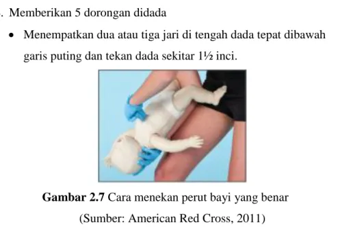 Gambar 2.7 Cara menekan perut bayi yang benar  (Sumber: American Red Cross, 2011) 