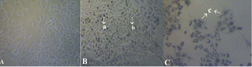 Gambar 6. Mekanisme pembentukan kristal formazan oleh enzim suksinat dehidrogenase pada mitokondria sel hidup 
