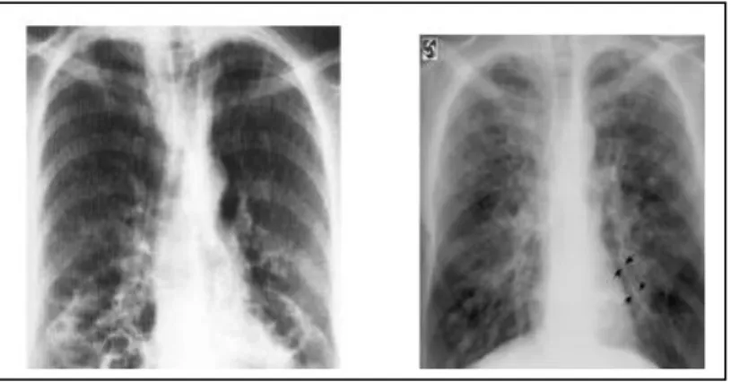 Gambar 4. Gambaran honeycomb appearance. 