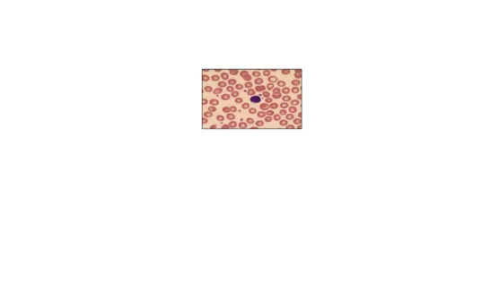 Gambar  5.  Limoosit  pada  peredaran  darah  (ungu),  di  sekitarnya  terdapat  eritrosit (merah), dan trombosit (ungu kecil).