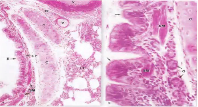 Gambar 17-8. Dinding bronkus. (a): Pandangan dengan pembesaran kuat bronkus memperlihatkan epitel (E) yang terutama berupa sel silindris bersilia bertingkat