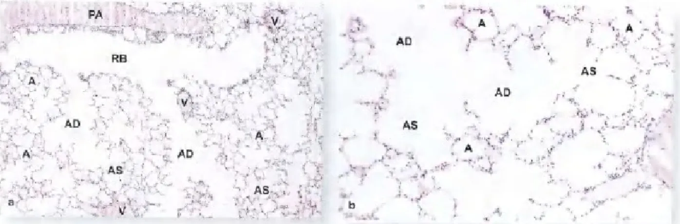 Gambar 17-11. Bronchiolus respiratorius, ductus alveolaris dan alveoli. Jaringan paru memiliki struktur berbusa karena banyaknya kantong dan saluran udara yang disebut alveoli