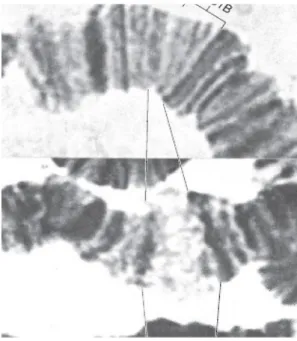 Gambar 3. Puffs pada kromosom politen Drosophila melanogaster  (Sumber: Tamarin, 2001)