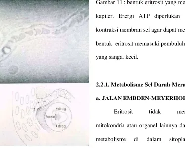 Gambar 11 : bentuk eritrosit yang melewati 