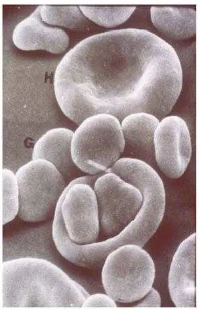 Gambar 1 : Hasil scanning micrograf elektorn eritrosit manusia (H) 