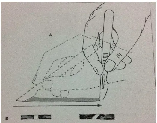 Gambar 3. Cara Memegang dan Fiksasi Scalpel 