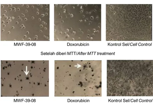 Figure 2. Morphology of T47D cells after being treated with MFW39 fungal extract and formazan crystal formed (arrows) after 3 hours exposing with MTT (100 x magnification).