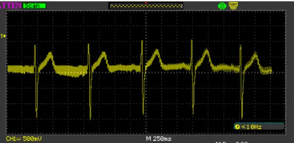 Gambar 7. Sinyal EKG Sebelum Penapisan 