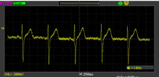 Gambar 8. Sinyal EKG Setelah Penapisan 2 tingkat 