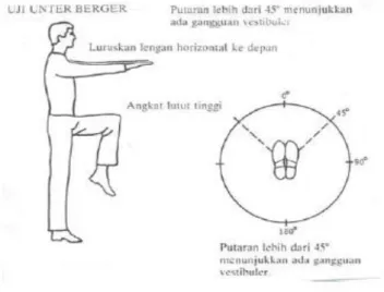 Gambar Uji Unterberger  4.  Past-pointing test (Uji Tunjuk Barany) 