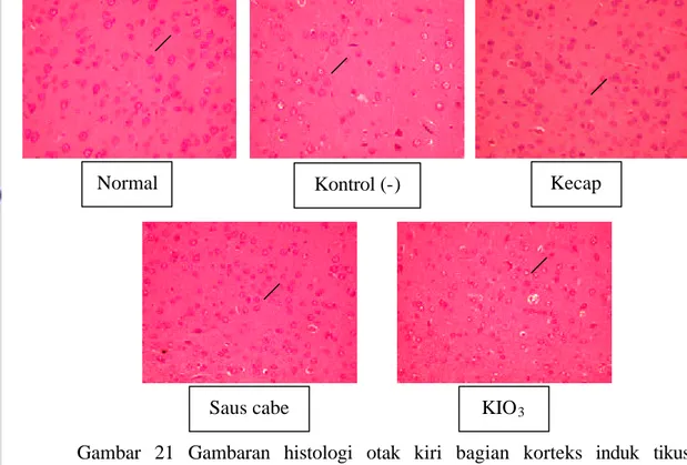 Gambar 21  Gambaran histologi otak kiri bagian korteks induk tikus   (perbesaran 200 kali) 