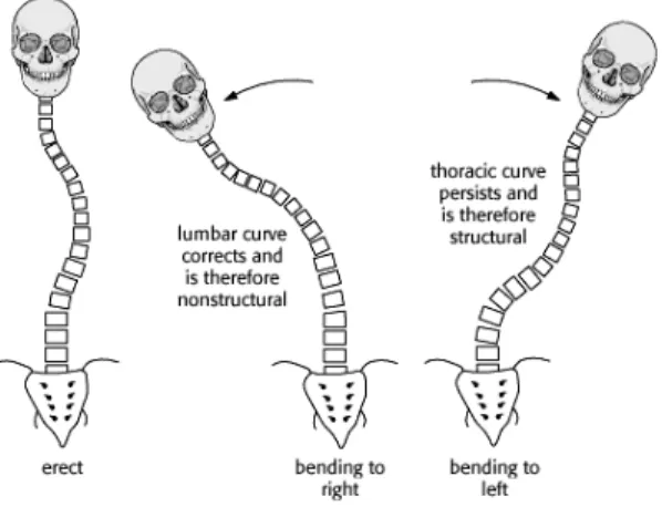 Gambar 9. “bending film” dapat membedakan skoliosis structural dan non  struktural 5