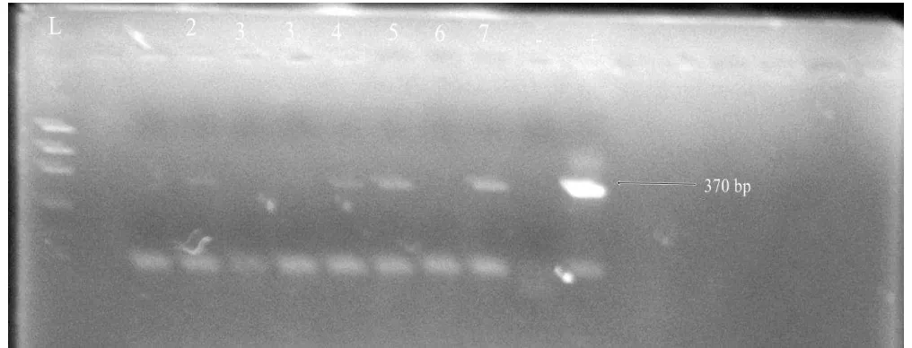 Gambar Hasil elektroporesis produk PCR, 