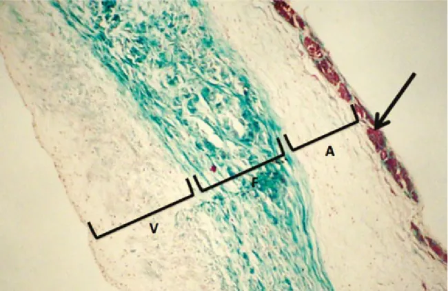 Fig. 2. Longitudinal section of a cusp from a male subject showing the general layout of laminae