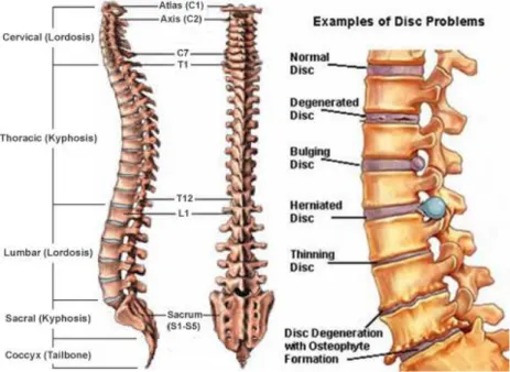 Gambar 3. Anatomi vertebrae   b.  Epidemiologi  