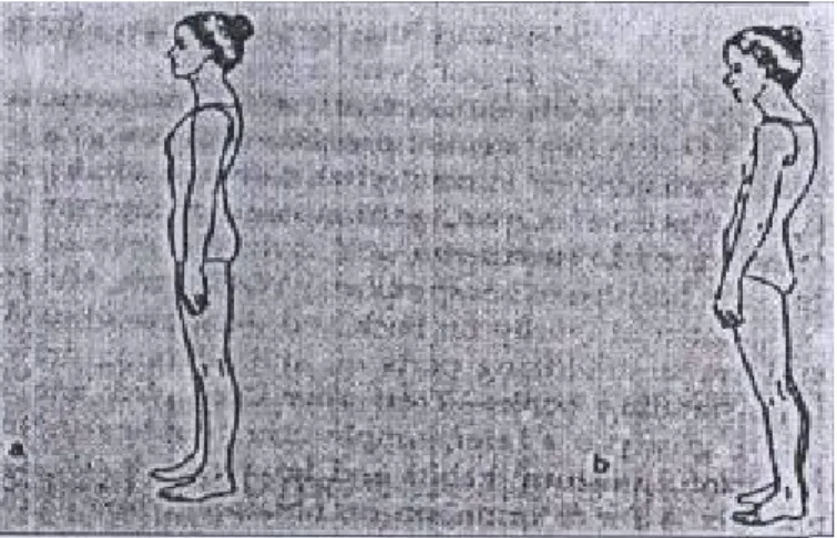 Gambar 1. Gambaran postur tubuh saat berdiri.  2  A. Postur berdiri yang benar,   B. Postur berdiri yang salah 