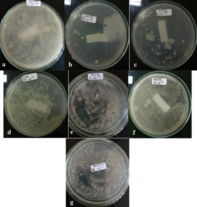 Gambar 2. (a) ALMK pengenceran 10 -2 ; (b) AMK pengenceran 10 -3 ; (c) HFK pengenceran 10 -4 ;   (d) JLM pengenceran 10 -3 ; (e) KUCB pengenceran 10 -3 ; (f) MHFK pengenceran 10 -3 ; dan  