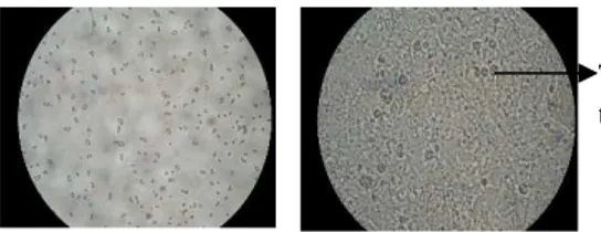 Gambar 5.  Foto  Ukuran  Tetes  Terdispersi Krim Antioksidan  dari  Kulit  Buah  Kakao  (Theobroma  cacao  L.)  Menggunakan  Mikroskop  Elektron  dengan  Perbesaran  100 Kali 