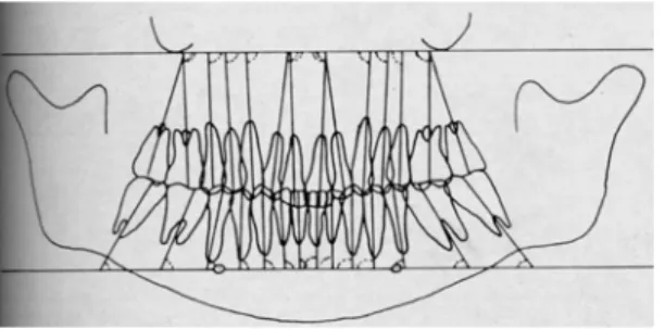 Gambar 5. Sudut-sudut angulasi yang diukur  (Diambil dari Ursi  3 ) 