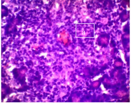 Gambar  4.  Gambaran  histopatologi  pankreas  pada  kelompok  perlakuan  (P2)  yang  menunjukkan  (a)  piknosis  (b)  sel  yang mengalami regenerasi