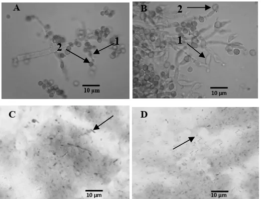 Gambar 1.  Foto mikroskopis jamur dan bakteri antagonis  Keterangan: (A). Trichoderma harzianum, (B)