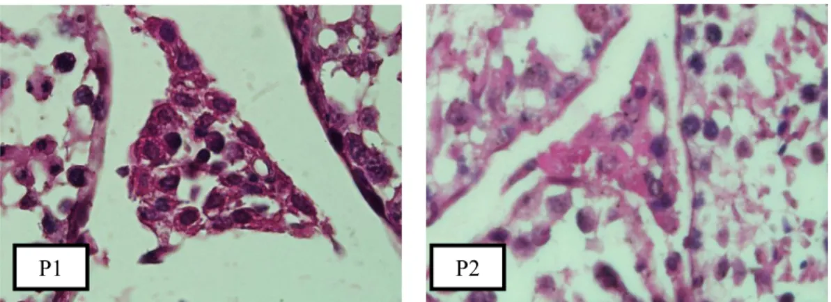 Gambar 2. Gambaran Perubahan Histopatologi Jaringan Interstitial Testis Mencit (Mus  musculus) Kelompok P1 (Kontrol Vitamin) dan Kelompok P2 (Kontrol  Boraks) (Perbesaran 1000 kali, Pewarnaan H.E.)