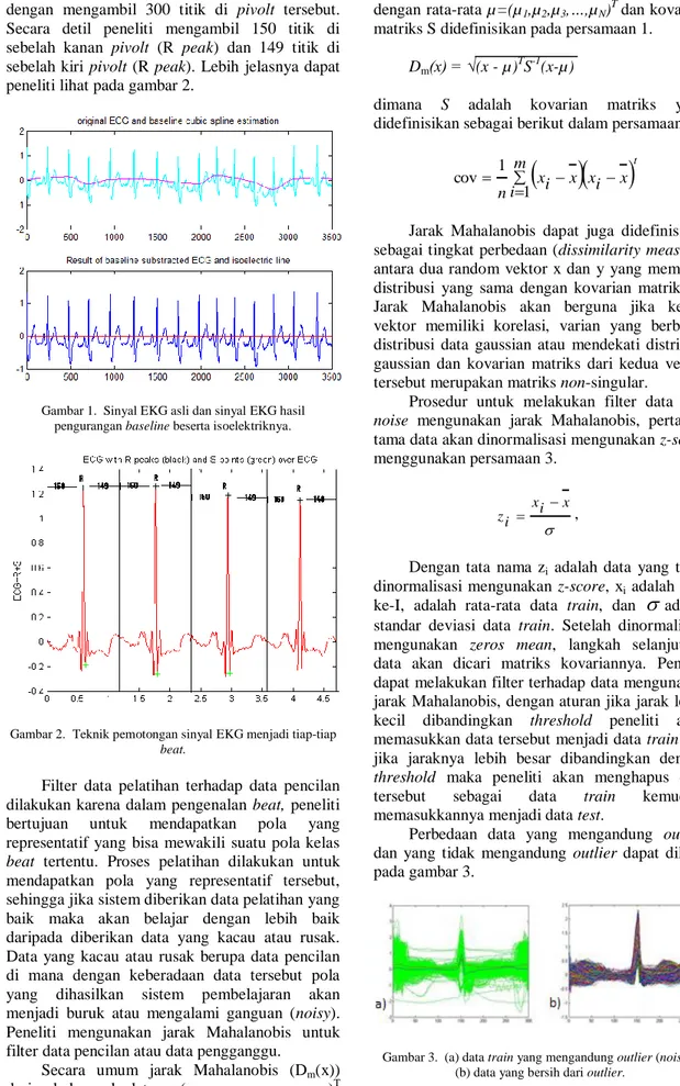 Gambar 1.  Sinyal EKG asli dan sinyal EKG hasil  pengurangan baseline beserta isoelektriknya