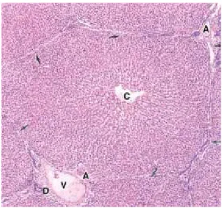 Gambar 2. Lobulus Hati. Arteriola (A), Venula (V), Duktus biliari (D), Venula sentralis (C) (Sumber: Mescher, 2007).