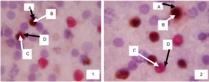 Gambar 2. Hasil pengecatan double staining  imunositokimia GR dan Hsp-90 pada hapusan 