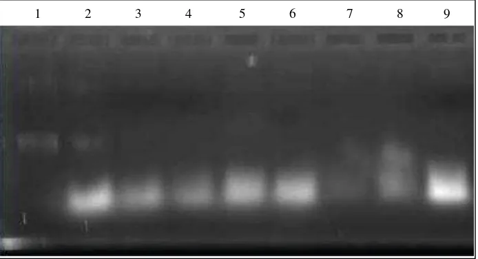 Gambar 1.Hasil elektroforegram dari sampel madu, (1) Kontrol DNA tanah, (2-5) Madu tanpa LB pada