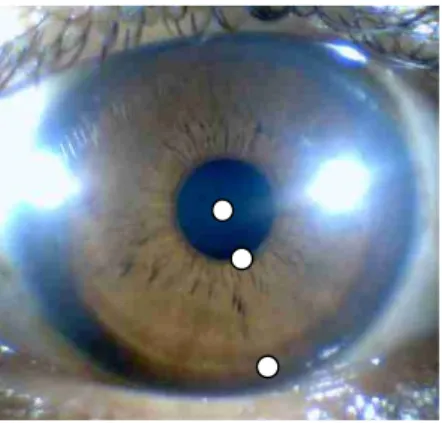 Gambar 3.4 Contoh penentuan tiga buah titik untuk  jari-jari mata, tepi luar pupil, dan tepi luar iris