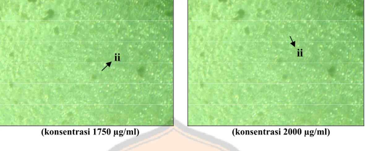 Gambar 4. Kultur sel mieloma di sumuran perlakuan (perbesaran 100x)  Ket. : i = sel mieloma hidup dan ii = sel mieloma mati 