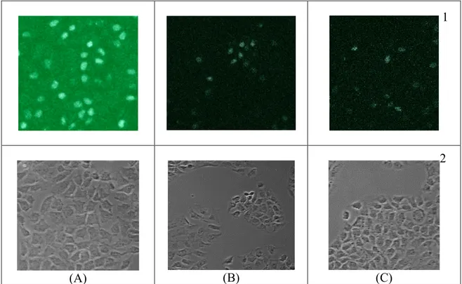 Gambar 2. Profil pertumbuhan sel T47D berdasarkan serapan formazan pengaruh induksi kurkumin (A)  dan PGV-0 (B) pada berbagai konsentasi pada pengamatan berbagai waktu 