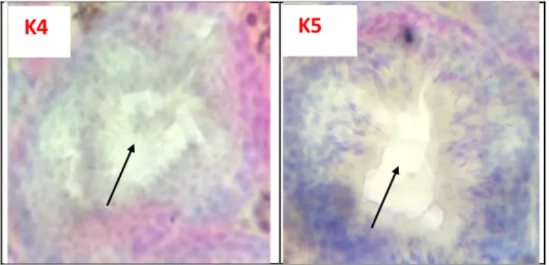 Gambar 2. Irisan melintang testis memperlihatkan kepadatan             spermatozoa setelah pemberian ekstrak tumbuhan 
