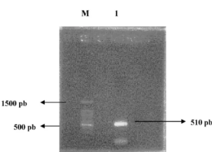 Gambar 1.  Hasil PCR termutasi pada gen dip22 (M = Marker  100 pb DNA Ladder, 1 = gen dip22 termutasi)