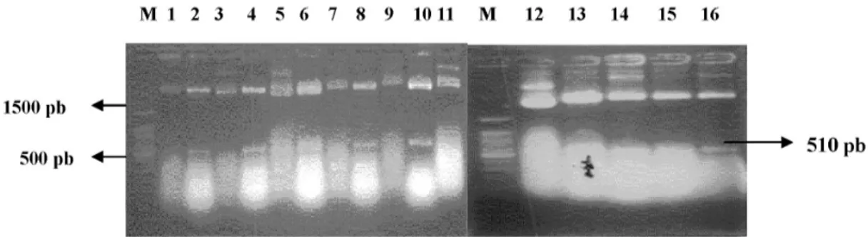 Gambar 4.  Hasil pemotongan DNA plasmid dengan EcoRI (M = marker DNA Ladder 100 pb, 1 = DNA klon no