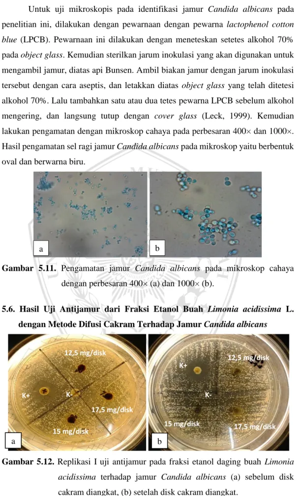 Gambar  5.11.  Pengamatan  jamur  Candida  albicans  pada  mikroskop  cahaya  dengan perbesaran 400× (a) dan 1000× (b)