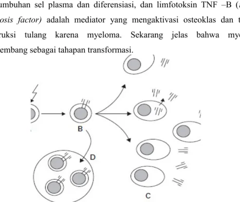 Gambar 6. Patogenesis myeloma: (A) Onkogenik dalam Sel B; (B) Perluasan klon sel B ganas; (C) proliferasi sel plasma menyebabkan lesi tulang dan produksi paraprotein; (D) penekanan sel B yang normal menyebabkan hipogamaglobulinemia