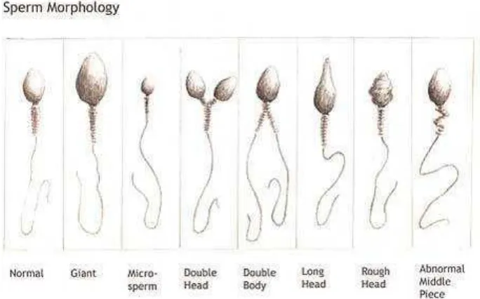 Gambar II.1 Macam-macam Morfologi Sperma Sumber:wordpress.com 