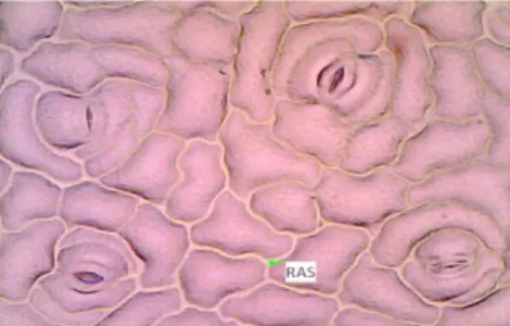 Gambar 2. Bentuk sel epidermis dan stomata daun  pakis giwang (Euphorbia milii)  (Perbesaran 400X)
