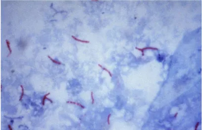 Gambar 6. Sputum BTA 