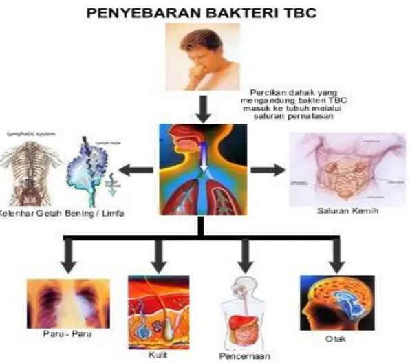 Gambar 2. Penyebaran bakteri Tuberkulosis 11 . 
