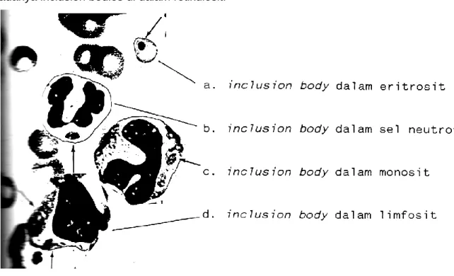 Gambar inclusion body dalam eritrosit dan leukosit. 