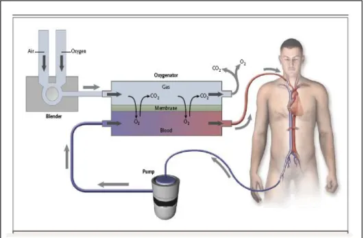 Gambar 7. Oksigenator pada ECMO venovenous  
