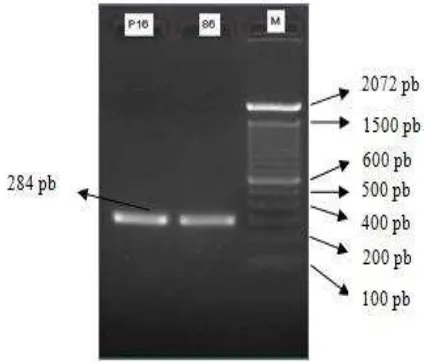 Gambar 5. Hasil Analisis Sepasang Primer dengangen fabG (mabA) sebagai DNA templat