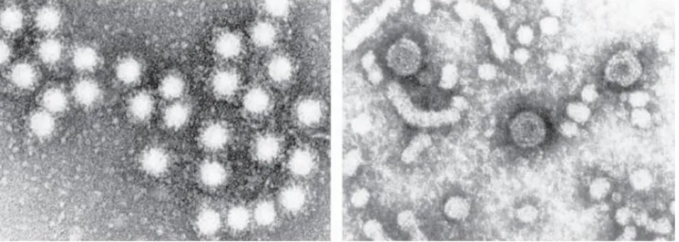 Gambar 1. Virus hepatitis A dilihat dalam mikroskop elektron (Longo et al, 2012) 