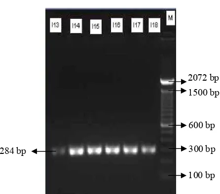 Gambar 1 Elektroforegram produk PCR hasil 
