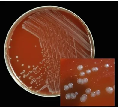Gambar 4. Kultur bakteri Neisseria gonorrhoeae 20