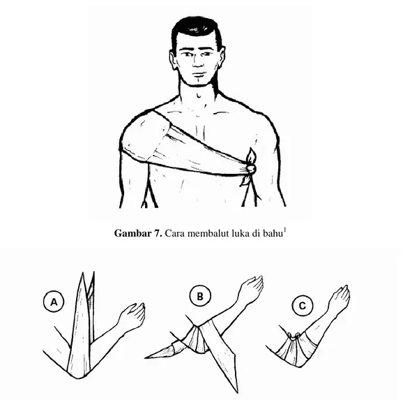 Gambar 7. Cara membalut luka di bahu 1 