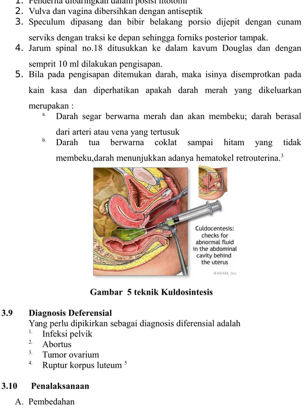 Gambar  5 teknik Kuldosintesis 3.9 Diagnosis Deferensial